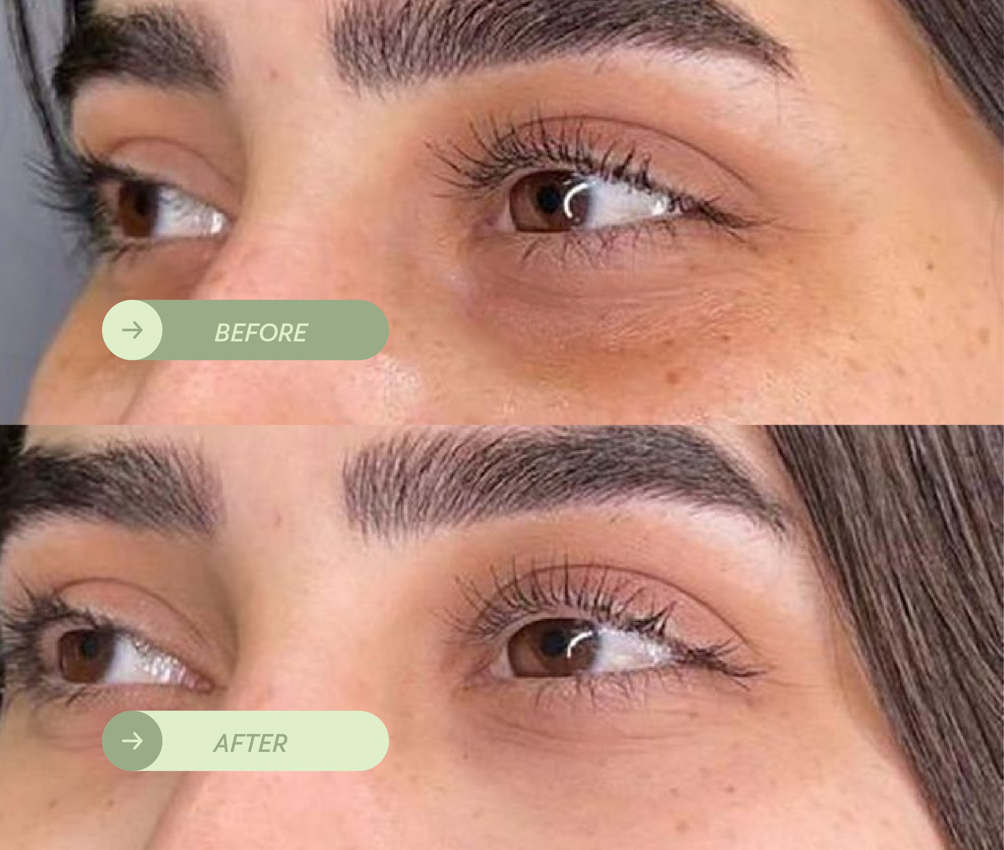 Under Eye Serum